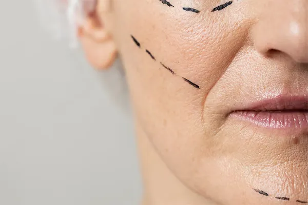 Anti-Aging Treatment